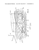 Methods of Locating and Tracking Robotic Instruments in Robotic Surgical     Systems diagram and image