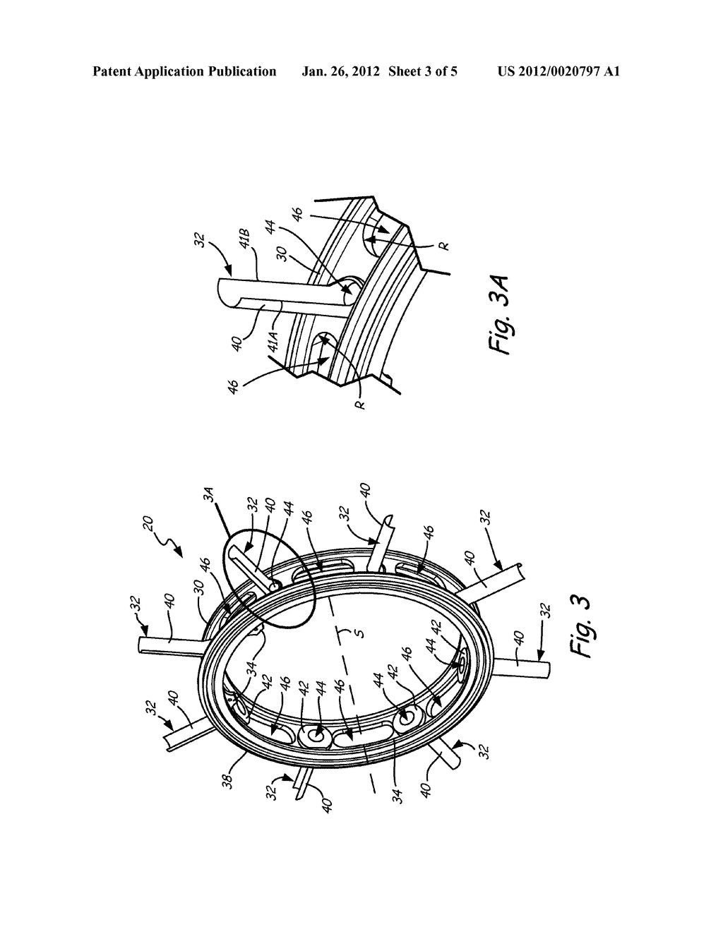 VORTEX REDUCING DEVICE FOR A GAS TURBINE ENGINE - diagram, schematic, and image 04