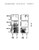 PROSTATE CANCER VACCINE diagram and image