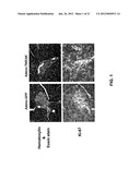 METHODS FOR PANCREATIC TISSUE REGENERATION diagram and image