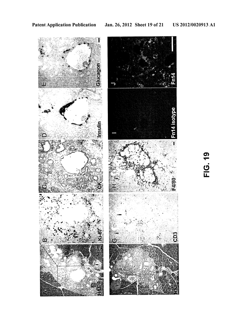 METHODS FOR PANCREATIC TISSUE REGENERATION - diagram, schematic, and image 20