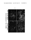 AUTOLOGOUS AND ALLOGENIC ADIPOSE-DERIVED STROMAL STEM CELL COMPOSITION FOR     TREATING FISTULAS diagram and image