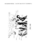 ANTIGEN BINDING PROTEINS TO PROPROTEIN CONVERTASE SUBTILISIN KEXIN TYPE 9     (PCSK9) diagram and image