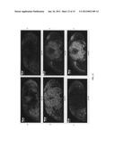 Pre-coated surfaces for analysis diagram and image