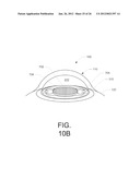 Model Human Eye and Face Manikin for Use Therewith diagram and image