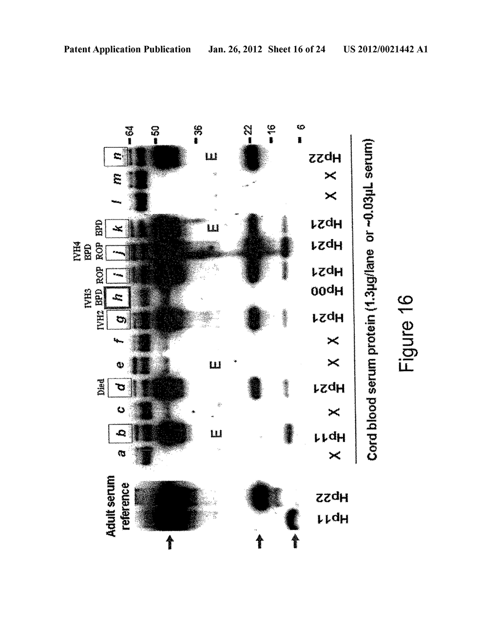 MARKERS FOR DETECTION OF COMPLICATIONS RESULTING FROM IN UTERO ENCOUNTERS - diagram, schematic, and image 17