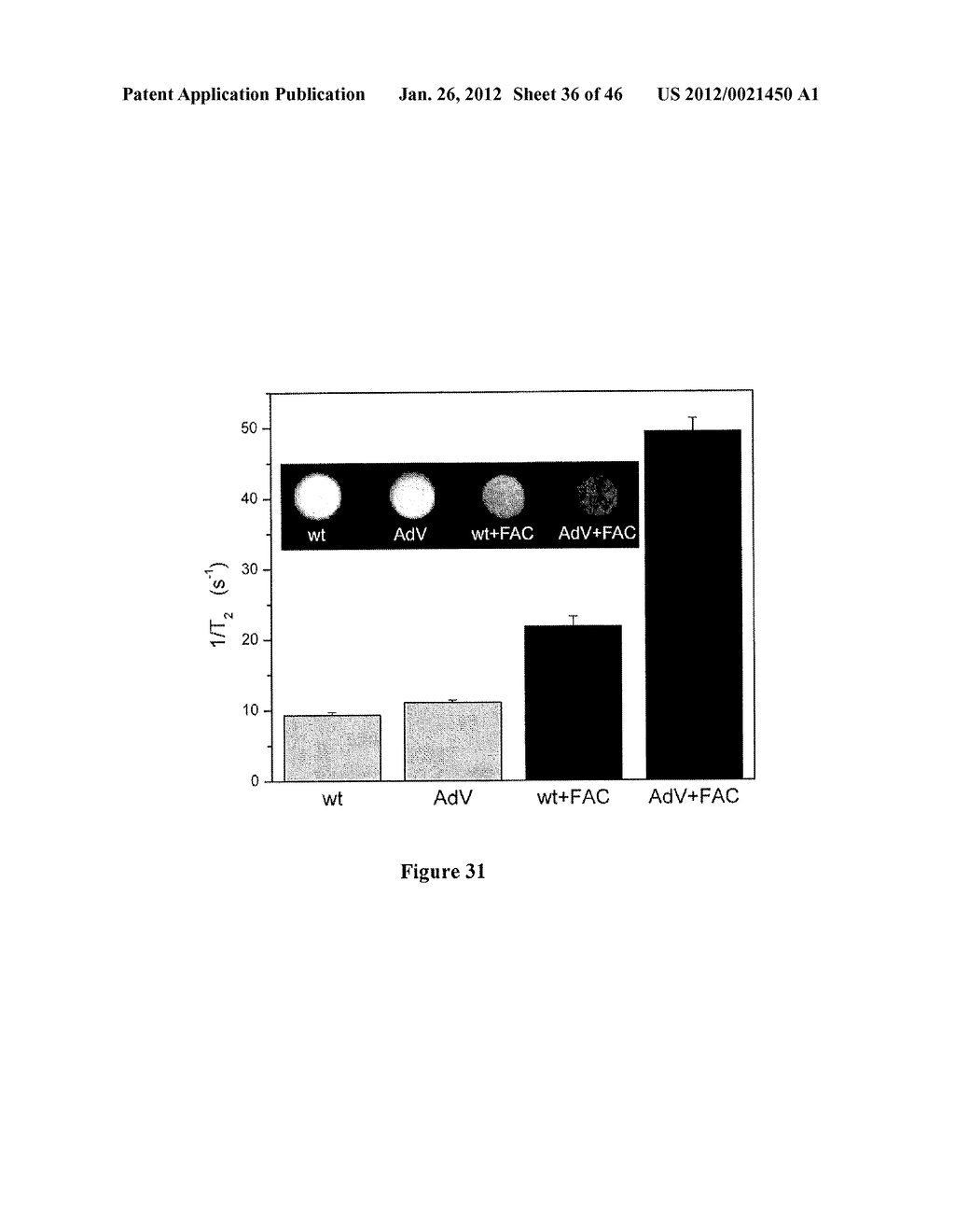 METHODS FOR MAGNETIC RESONANCE IMAGING - diagram, schematic, and image 37