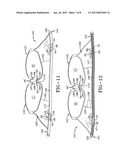 Front-opening and adjustable bra diagram and image