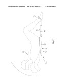 EXERCISE APPARATUS diagram and image