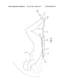 EXERCISE APPARATUS diagram and image