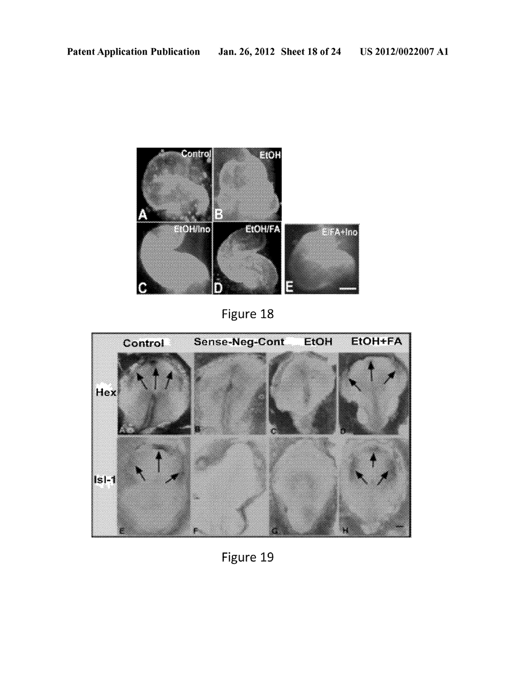 METHOD AND COMPOSITION FOR MODULATING CANONICAL WNT PATHWAY USING FOLATE     AND INOSITOL - diagram, schematic, and image 19