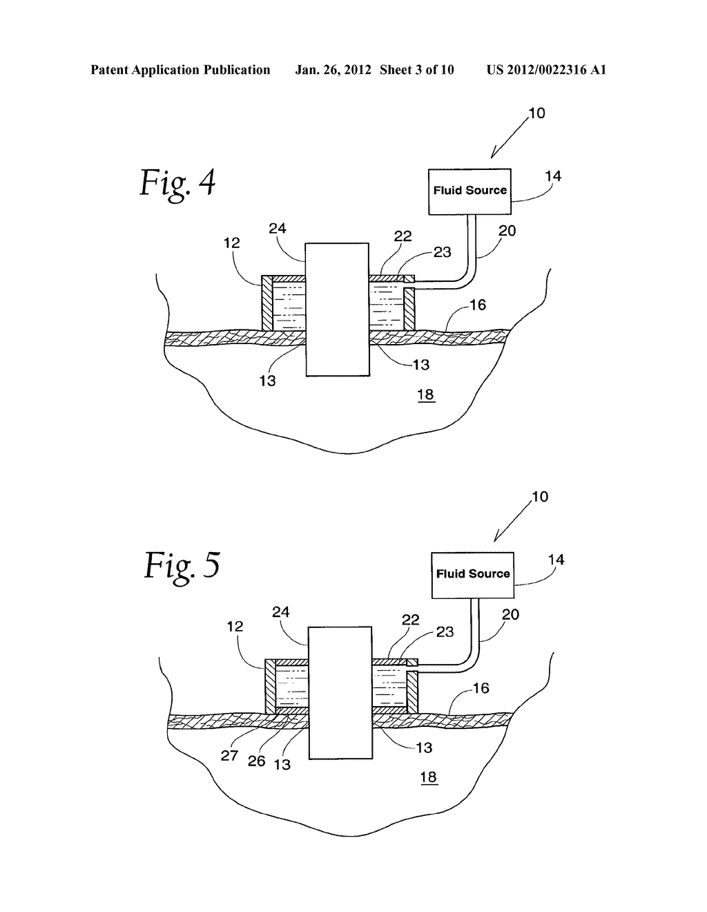 Method and Apparatus for Preventing Air Embolisms - diagram, schematic, and image 04