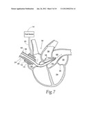 Method and Apparatus for Preventing Air Embolisms diagram and image