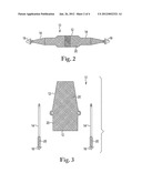 Coated Pelvic Implant Device and Method diagram and image