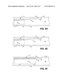 APPARATUSES FOR ADVANCING AN ENDOSCOPE THROUGH A PASSAGE diagram and image