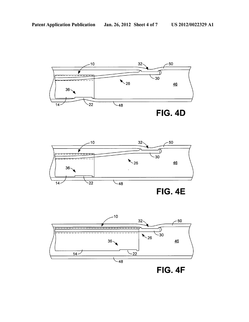 APPARATUSES FOR ADVANCING AN ENDOSCOPE THROUGH A PASSAGE - diagram, schematic, and image 05