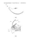 LARYNGOSCOPE, COMPRISING A SET OF MAGNETIC ELEMENTS diagram and image