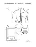 DETECTING SLEEP TO EVALUATE THERAPY diagram and image