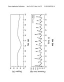 SENSOR FUSION AND PROBABILISTIC PARAMETER ESTIMATION METHOD AND APPARATUS diagram and image