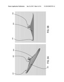 METHOD AND A SYSTEM FOR MEDICAL IMAGING diagram and image