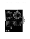 METHOD AND A SYSTEM FOR MEDICAL IMAGING diagram and image