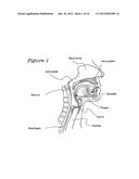 Method and Device for the Treatment of Obstructive Sleep Apnea and Snoring diagram and image