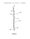 ADJUSTABLE EXTENSION COMPRESSION POSTERIOR SPINAL ORTHOSIS AND METHOD diagram and image