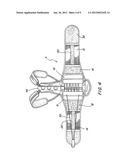 ADJUSTABLE EXTENSION COMPRESSION POSTERIOR SPINAL ORTHOSIS AND METHOD diagram and image