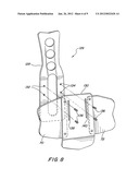 ADJUSTABLE EXTENSION COMPRESSION POSTERIOR SPINAL ORTHOSIS AND METHOD diagram and image