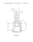 ADJUSTABLE EXTENSION COMPRESSION POSTERIOR SPINAL ORTHOSIS AND METHOD diagram and image