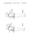 ADJUSTABLE EXTENSION COMPRESSION POSTERIOR SPINAL ORTHOSIS AND METHOD diagram and image