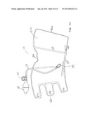 VENOUS CLOSURE CATHETER AND METHOD FOR SCLEROTHERAPY diagram and image