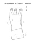 VENOUS CLOSURE CATHETER AND METHOD FOR SCLEROTHERAPY diagram and image