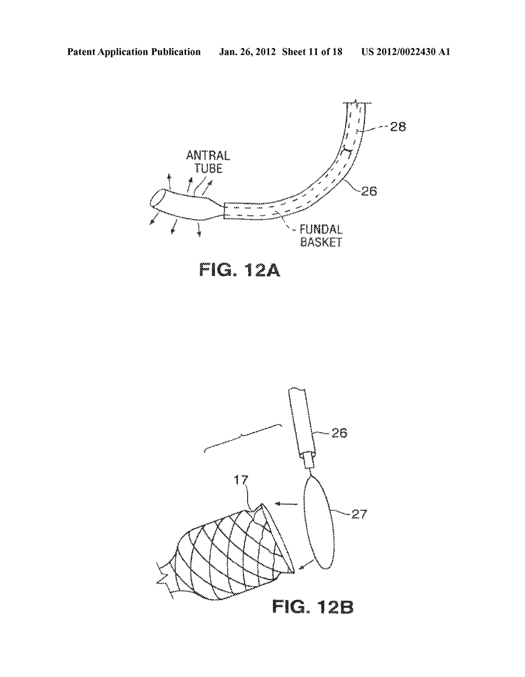 SATIATION DEVICES AND METHODS - diagram, schematic, and image 12