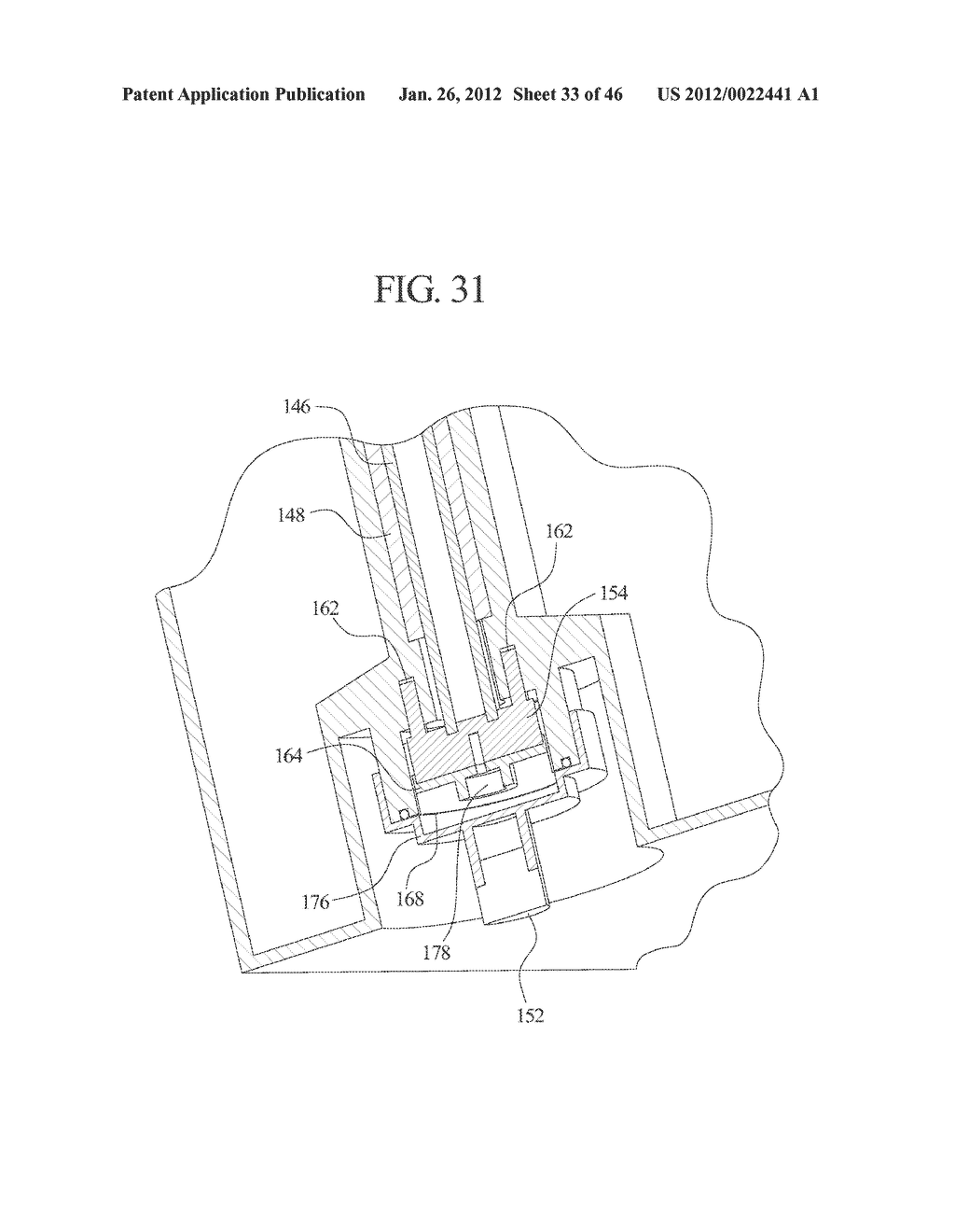 MEDICAL FLUID PUMP VALVE INTEGRITY TEST METHODS AND SYSTEMS - diagram, schematic, and image 34