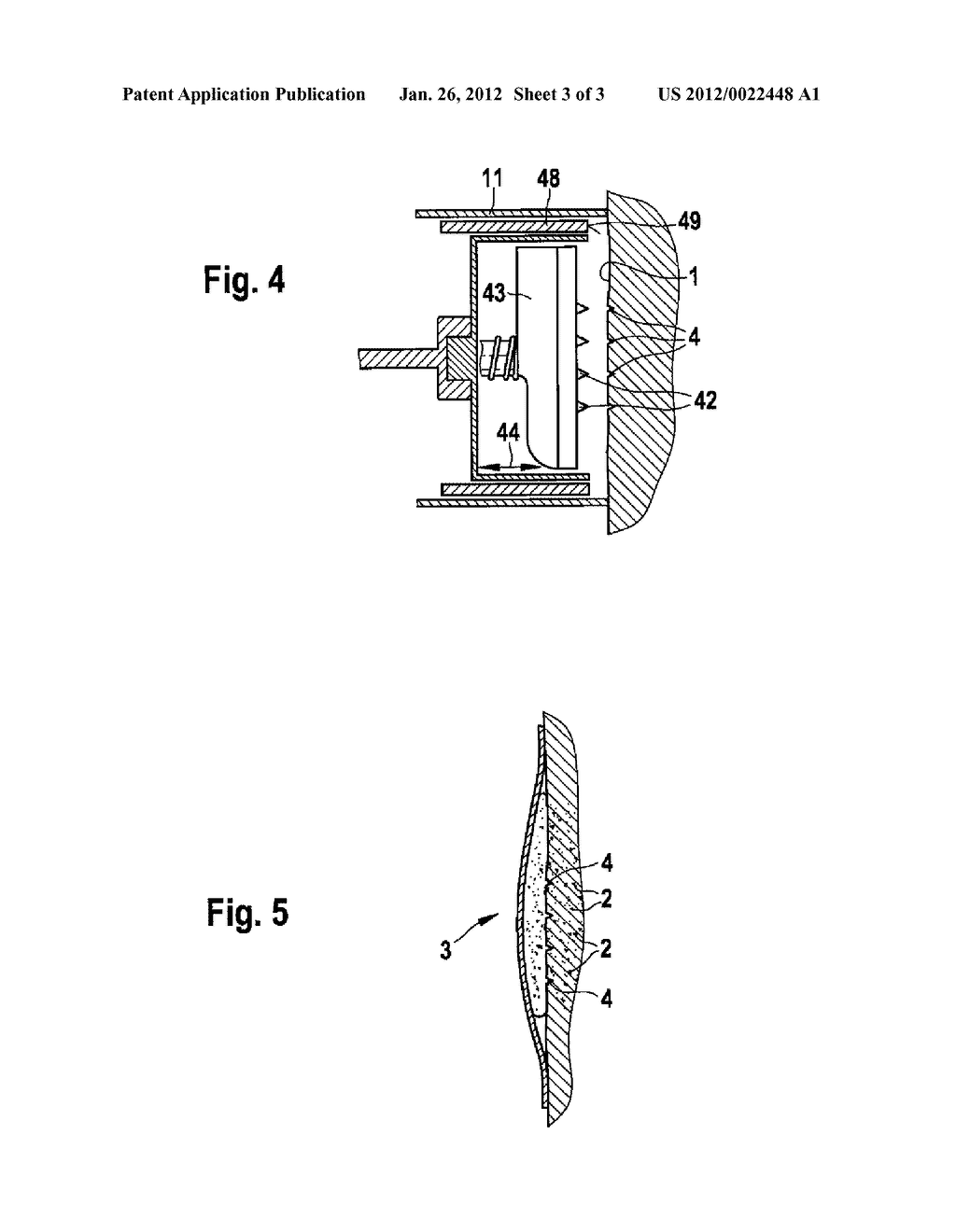 Applicator for Treating Skin - diagram, schematic, and image 04