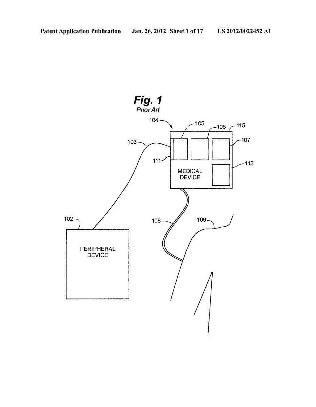 AMBULATORY MEDICAL DEVICE WITH ELECTRICAL ISOLATION FROM CONNECTED     PERIPHERAL DEVICE - diagram, schematic, and image 02