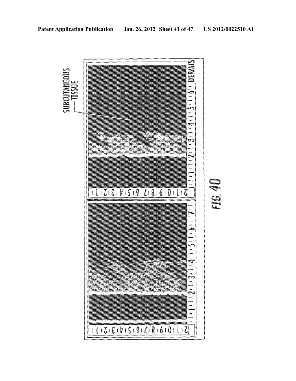 THERMAL SURGERY SAFETY APPARATUS AND METHOD - diagram, schematic, and image 42