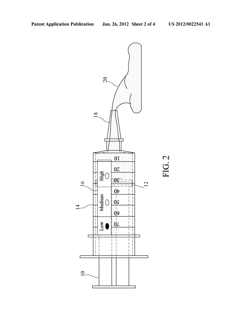 BONE REPLACEMENT MATERIAL DELIVERY DEVICES AND METHODS OF MONITORING BONE     REPLACEMENT MATERIAL - diagram, schematic, and image 03