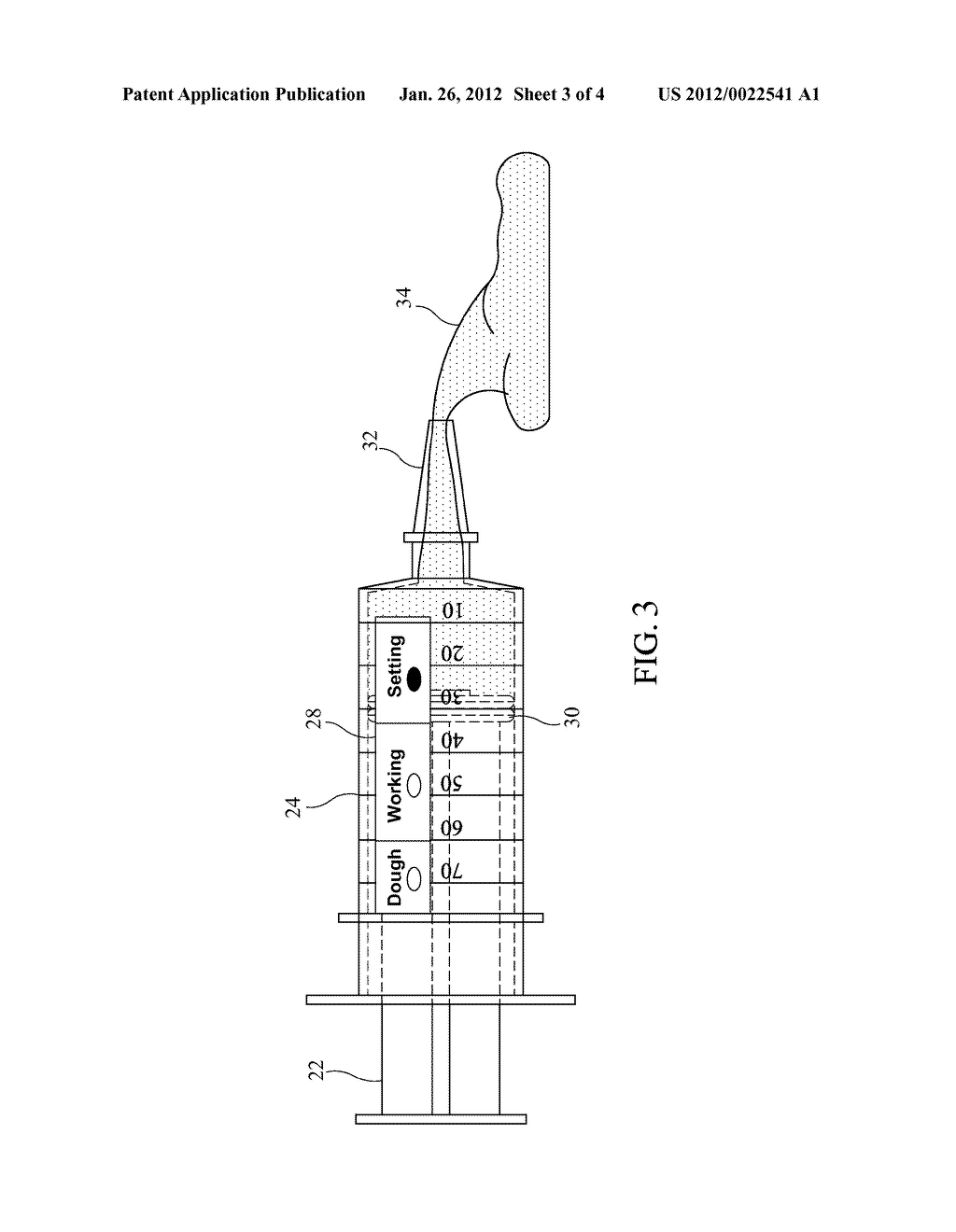 BONE REPLACEMENT MATERIAL DELIVERY DEVICES AND METHODS OF MONITORING BONE     REPLACEMENT MATERIAL - diagram, schematic, and image 04