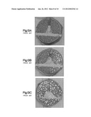 BONE CEMENT SYSTEM FOR BONE AUGMENTATION diagram and image