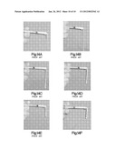 BONE CEMENT SYSTEM FOR BONE AUGMENTATION diagram and image