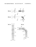 SURGICAL INSTRUMENT diagram and image