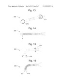 SURGICAL INSTRUMENT diagram and image