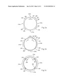 ANGIOPLASTY BALLOON WITH CONCEAL WIRES diagram and image