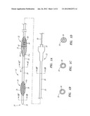 OCCLUSION DEVICE AND METHOD OF USE diagram and image