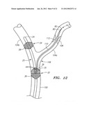 OCCLUSION DEVICE AND METHOD OF USE diagram and image