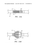 OCCLUSION DEVICE AND METHOD OF USE diagram and image