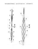 OCCLUSION DEVICE AND METHOD OF USE diagram and image