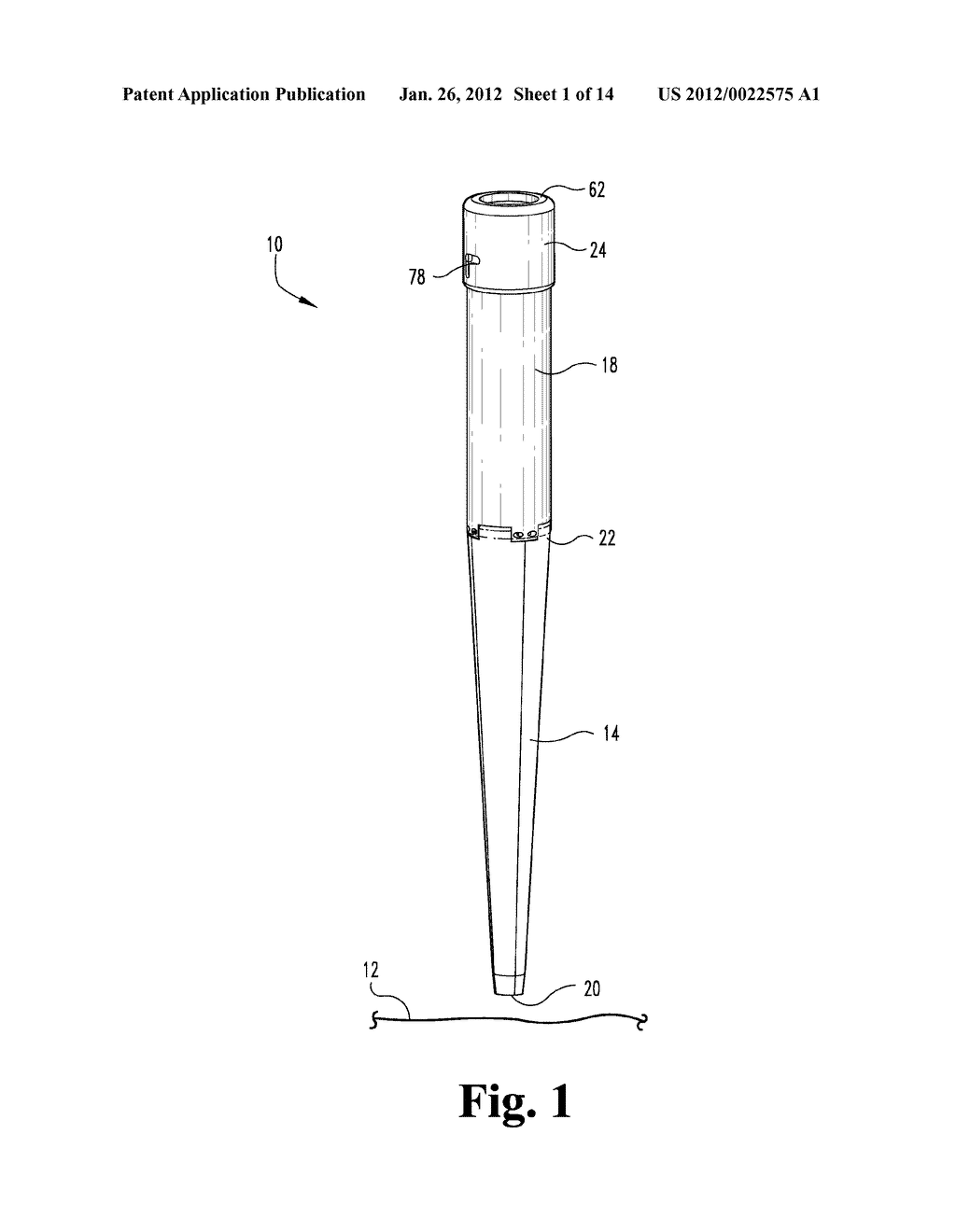 LATERALLY EXPANDING SURGICAL DILATOR - diagram, schematic, and image 02